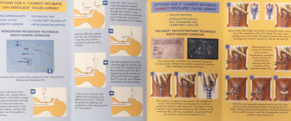 The Airway Card-Anesthesia